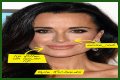 Botox, Implants & More! – Hollywood Life