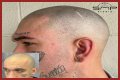 Unveiling The Truth: Steve Austin's Baldness Decoded